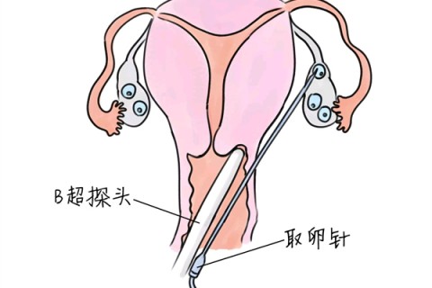 http://guiyang.vdtfzz.com/post/205.html|贵阳供卵助孕