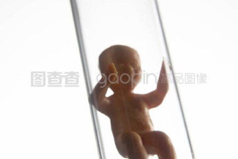 http://guiyang.vdtfzz.com/post/197.html|贵阳试管助孕